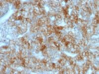 Staining by anti-Ksp-Cadherin / CDH16 Antibody 1