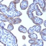 Staining by anti-Adipophilin / Perilipin-2 Antibody 1