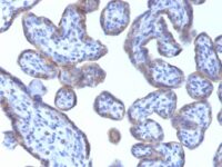 Staining by anti-Adipophilin / Perilipin-2 Antibody 1