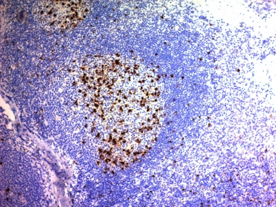 Formalin-fixed, paraffin-embedded human Tonsil stained with CD57 Monoclonal Antibody (NK/84).