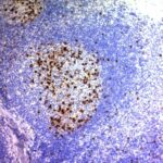 Formalin-fixed, paraffin-embedded human Tonsil stained with CD57 Monoclonal Antibody (NK/84).