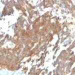 Staining by anti-GnRH-Receptor / LH-RH Receptor Antibody 1