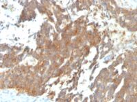 Staining by anti-GnRH-Receptor / LH-RH Receptor Antibody 1