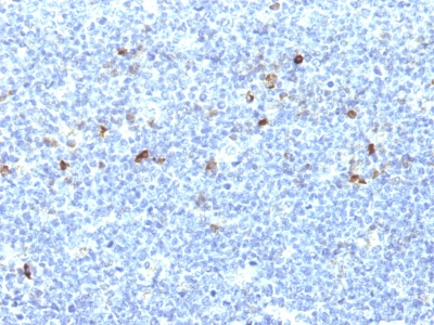 Formalin-fixed, paraffin-embedded human Tonsil stained with MHC I Monoclonal Antibody (CATA-1).