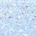 Formalin-fixed, paraffin-embedded human Tonsil stained with MHC I Monoclonal Antibody (CATA-1).