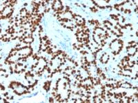 Staining by anti-FOXA1 / HNF3A Antibody 1