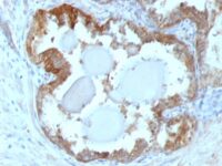 Staining by anti-HSP27 Antibody 1