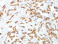 Staining by anti-HSP27 Antibody 1