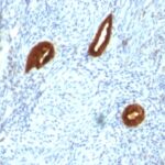 Staining by anti-Cytokeratin 19 Antibody 1