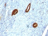 Staining by anti-Cytokeratin 19 Antibody 1