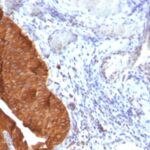 Staining by anti-Cytokeratin 19 Antibody 1