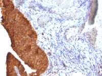 Staining by anti-Cytokeratin 19 Antibody 1