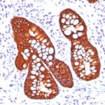 Staining by anti-Cytokeratin 19 Antibody 1