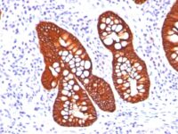 Staining by anti-Cytokeratin 19 Antibody 1