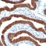 Staining by anti-Cytokeratin 19 Antibody 1