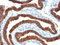 Staining by anti-Cytokeratin 19 Antibody 1