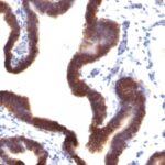 Staining by anti-Ep-CAM / CD326 Antibody 1