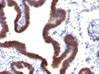 Staining by anti-Ep-CAM / CD326 Antibody 1