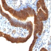 Staining by anti-Ep-CAM / CD326 Antibody 1