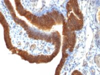 Staining by anti-Ep-CAM / CD326 Antibody 1