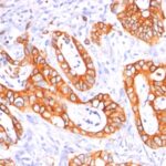 Staining by anti-MUC1 / EMA / CD227 Antibody 1