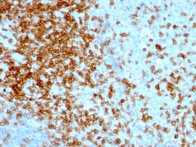 Formalin-fixed, paraffin-embedded human Tonsil stained with CD43 Monoclonal Antibody (84-3C1).