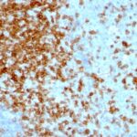 Formalin-fixed, paraffin-embedded human Tonsil stained with CD43 Monoclonal Antibody (84-3C1).