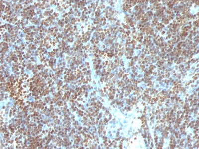Staining by anti-Double Stranded DNA Antibody 1