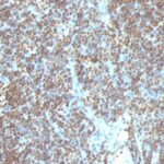 Staining by anti-Double Stranded DNA Antibody 1