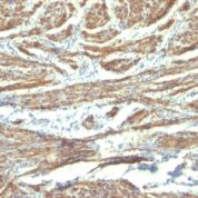 Formalin-fixed, paraffin-embedded human Uterus stained with Caldesmon Monoclonal Antibody (CALD1/82 + h-CALD).