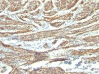 Formalin-fixed, paraffin-embedded human Uterus stained with Caldesmon Monoclonal Antibody (CALD1/82 + h-CALD).