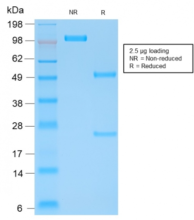 deken Notebook Informeer Kappa Light Chain (B-Cell Marker) Ultraspecific Antibody Tested against  >20,000 Human Proteins – enQuire BioReagents