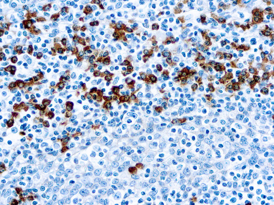 Igg Antibody Photos and Images & Pictures