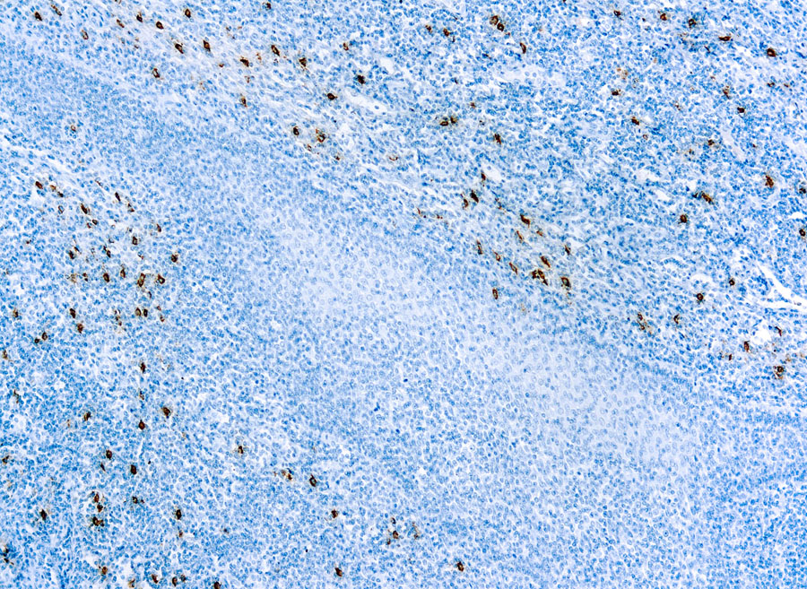 Mast Cell Tryptase [AA1] Antibody (cGMP). – enQuire BioReagents